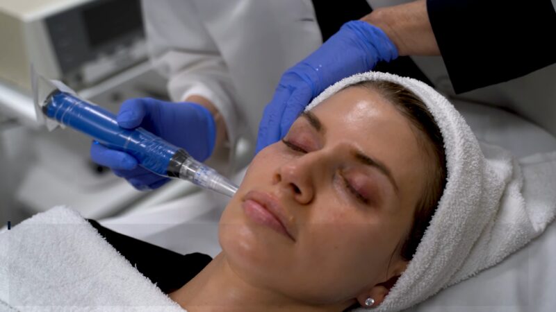 Microneedling - Skin Conditions